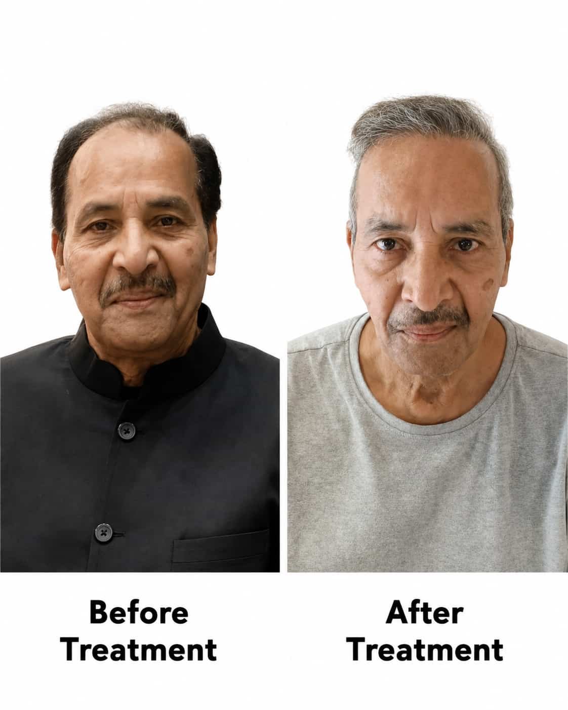 Honnete aesthetics Hair Result