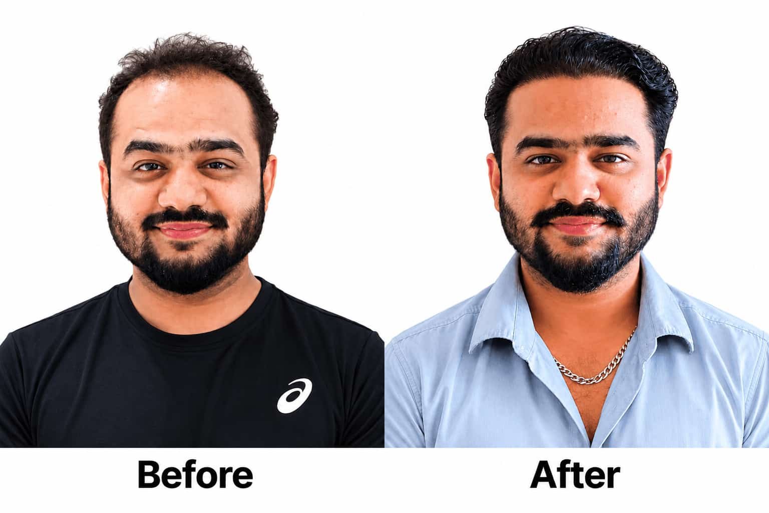 Honnete Aesthetics Before After Image